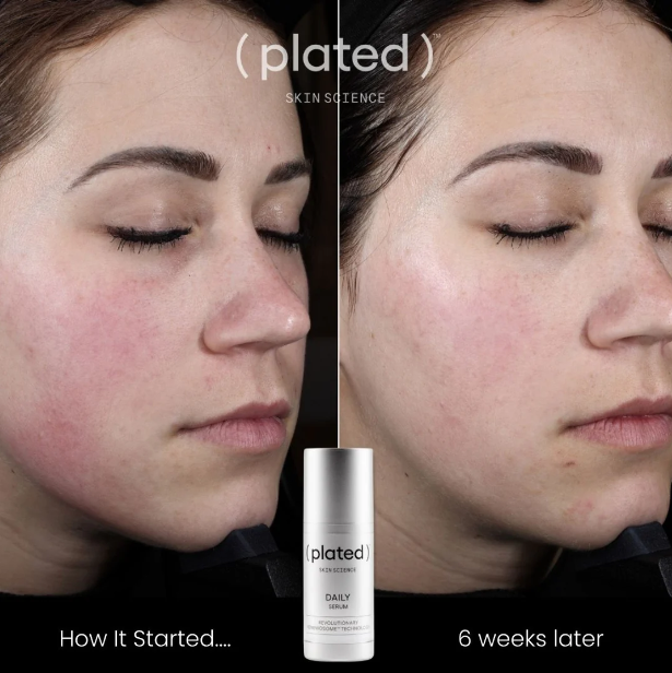 ( plated )™ Daily Serum