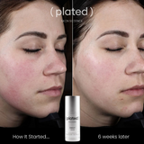 ( plated )™ Daily Serum